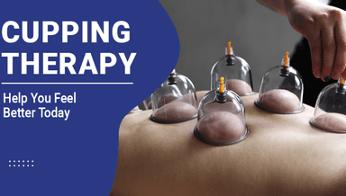 Image for 60 Minute Cupping Therapy Treatment